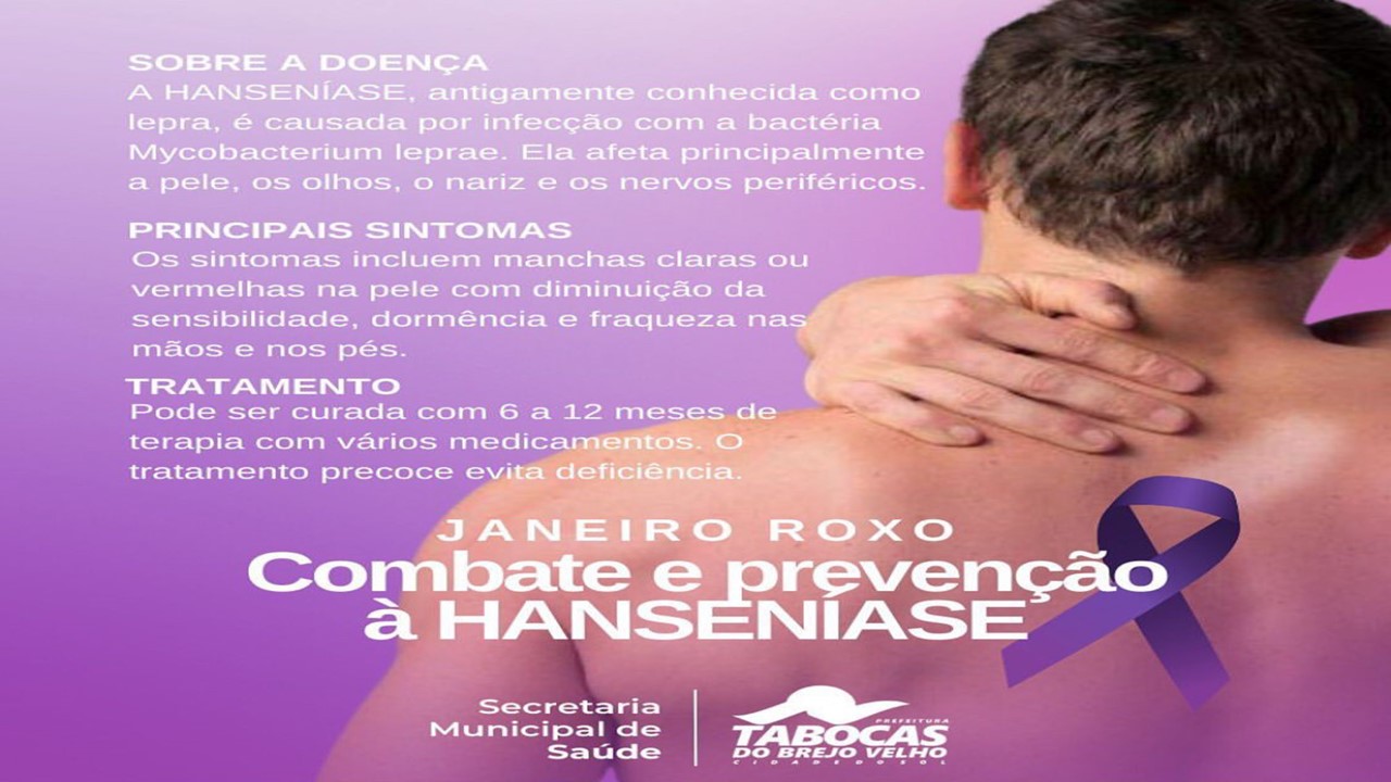 Prefeitura Municipal de Volta Redonda - JANEIRO ROXO: Volta Redonda promove  ações na campanha de controle e prevenção da hanseníase